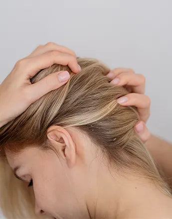 Шампоан против пърхот: жени с коса, показваща пърхот, с ръце на скалпа.